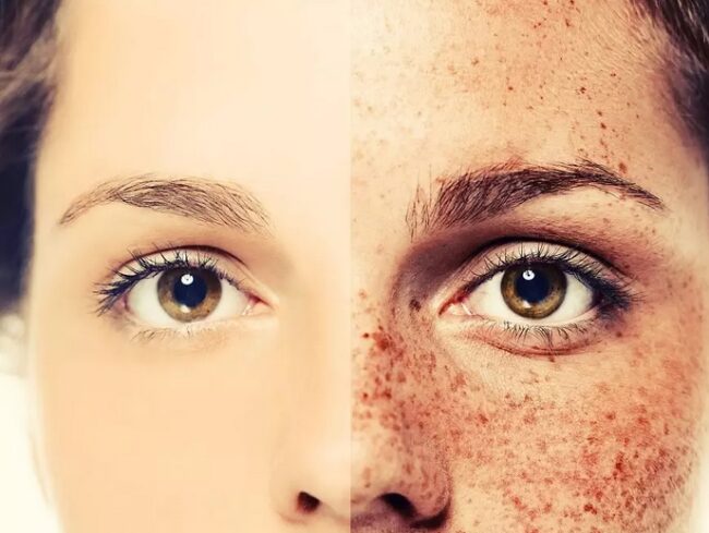 europa-press-manchas