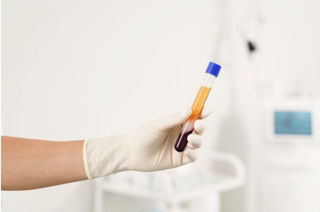 plasma rico en plaquetas