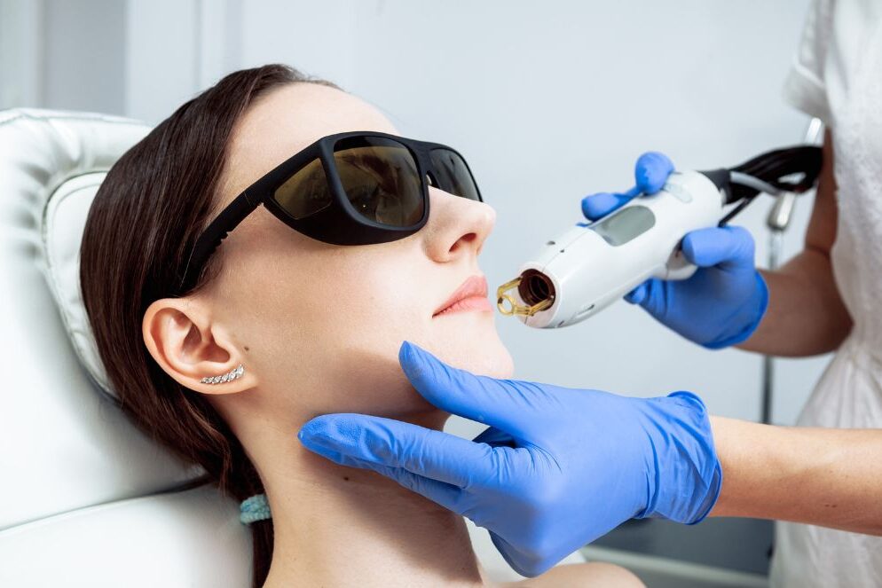 tratamiento con luz pulsada intensa contra las manchas faciales